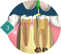 Endodontie